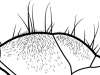 pronotum with dense pubescense
